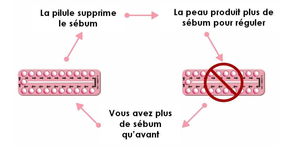 Sous pilule contraceptive, la peau produit plus de sébum, ce qui risque d'engendrer de l'acné après l'arrêt