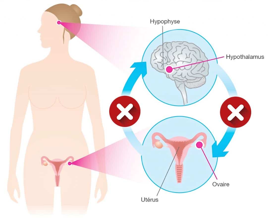 Sous pilule contraceptive, la communication entre le cerveau et les ovaires est coupée sous l'effet des hormones de synthèse